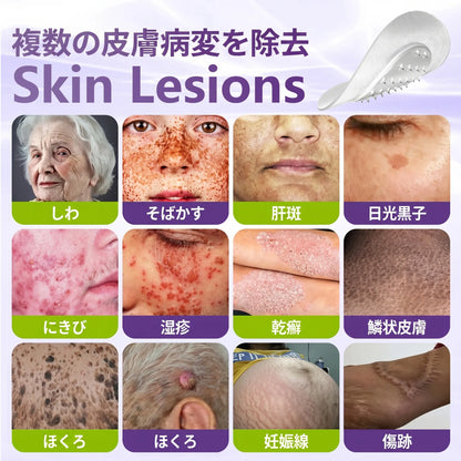 GFOUK® Soluble Microneedle Botanical Skin Tag Removal Patch