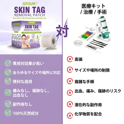 GFOUK® Soluble Microneedle Botanical Skin Tag Removal Patch